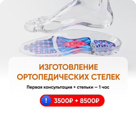 Изготовление ортопедических стелек в Бэби Плюс
