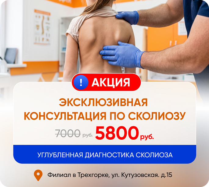 КОНСУЛЬТАЦИЯ ПО СКОЛИОЗУ