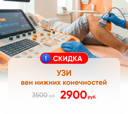 Специальные цены на УЗИ вен нижних конечностей 